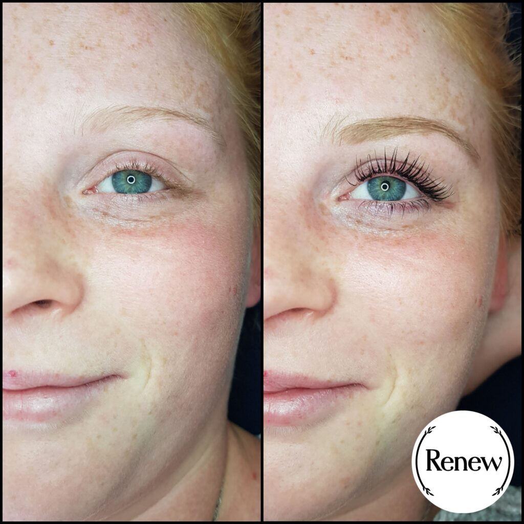 Lash lift before and after comparison highlighting enhanced eyelashes.