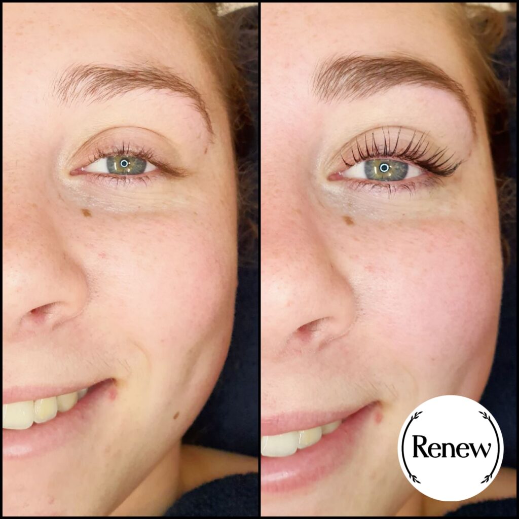 Lash lift transformation showcasing enhanced and curled lashes at Renew You.