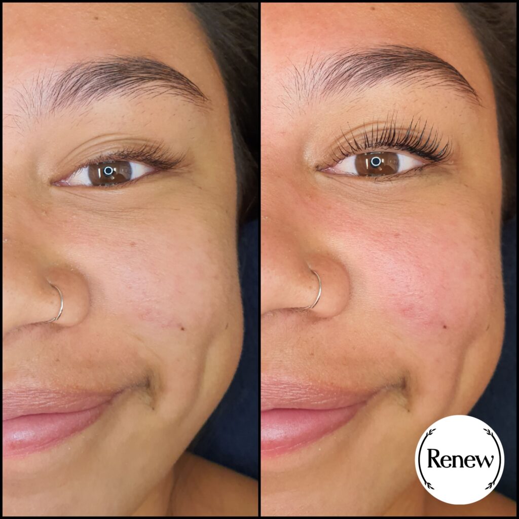 Before and after comparison of a lash lift at Renew You.