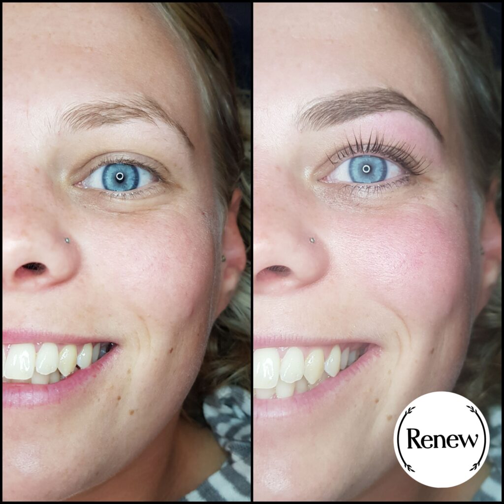 Before and after image of a lash lift treatment at Renew You.