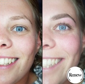 Before and after showcasing the impact of a Renew You lash lift.