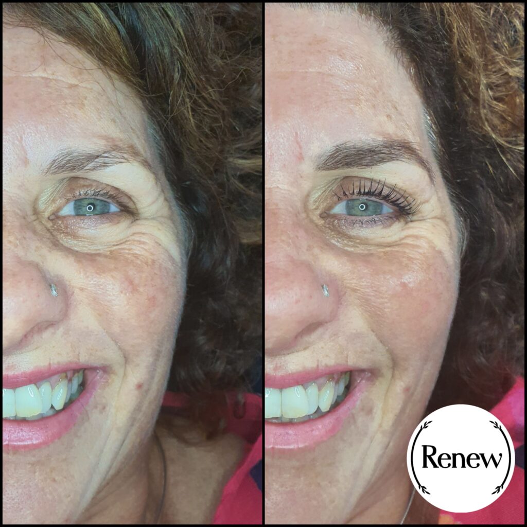 Side-by-side comparison before and after a lash lift at Renew You.