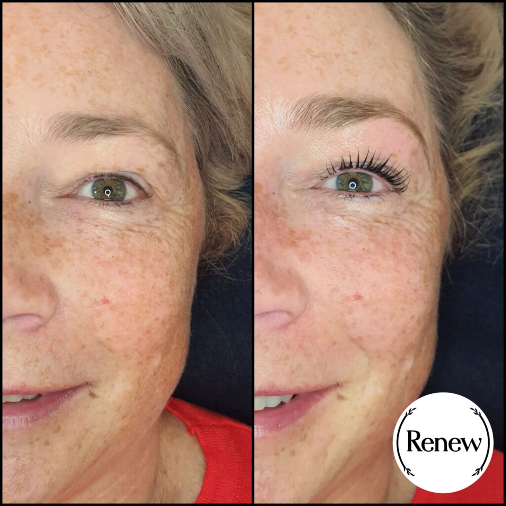Before and after of a lash lift treatment at Renew You.