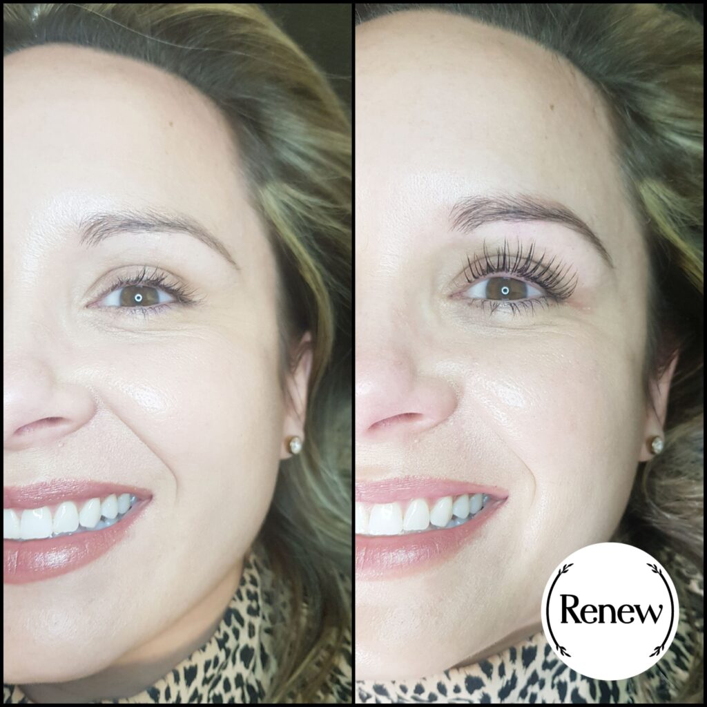 Before-and-after comparison of a lash lift treatment at Renew You.