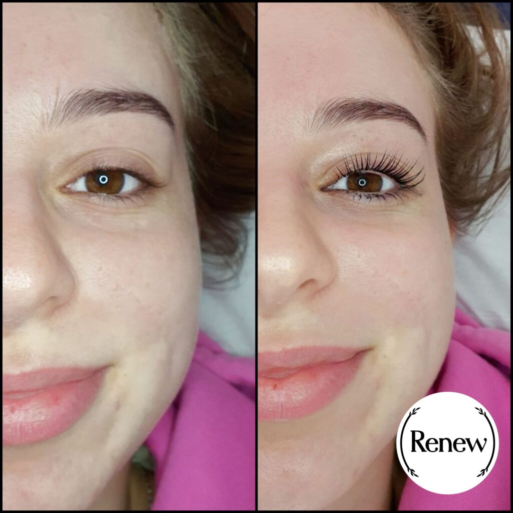 Before and after of a Renew You lash lift treatment.